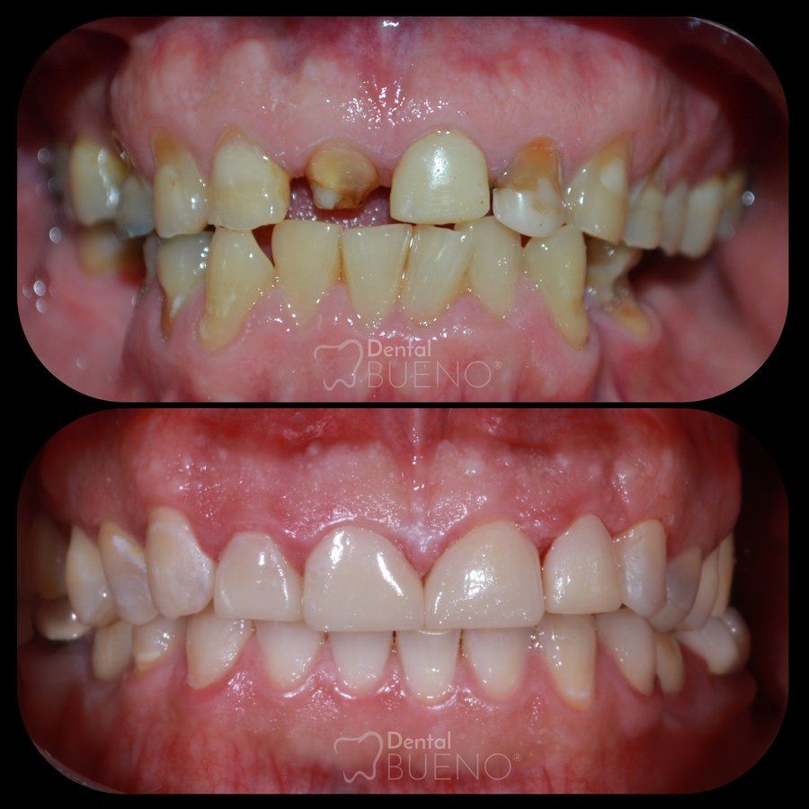 Dental Bueno - Dental Bueno