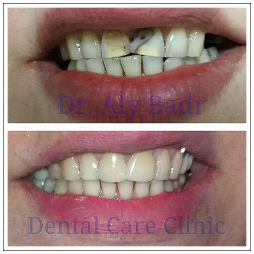 Dental Care Clinic - Dental Care Clinic