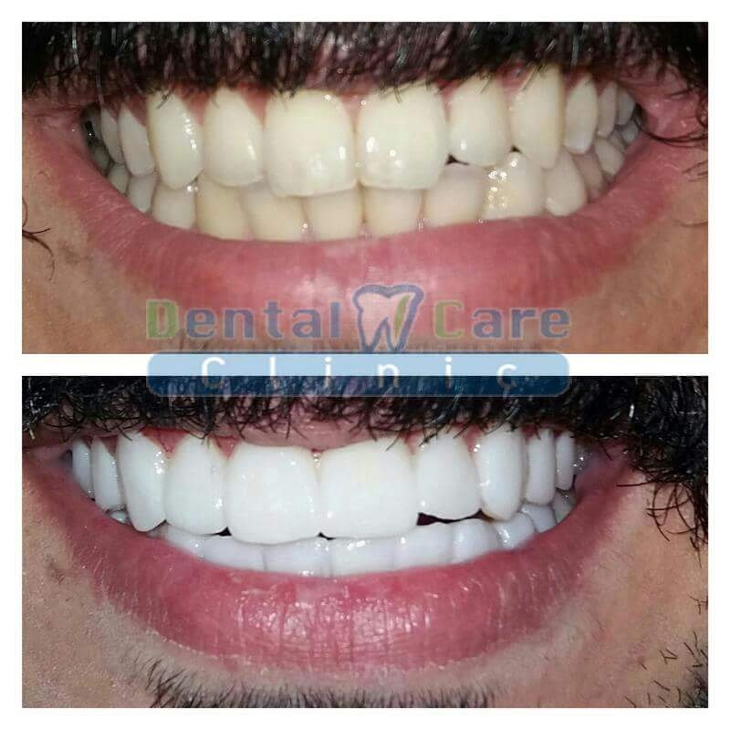 Dental Care Clinic - Dental Care Clinic