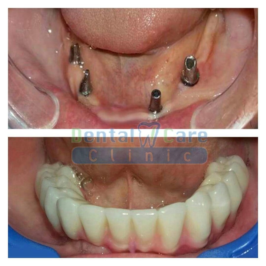 Dental Care Clinic - Dental Care Clinic