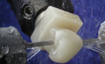 Dental Care Egypt - Dental Care Egypt