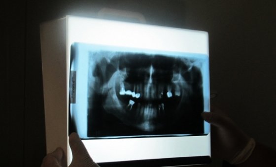 Dental Care Playacar - Dental Care Playacar