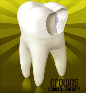 Dental Care Playacar - Dental Care Playacar