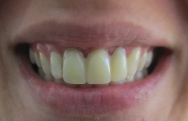 Dental Care Playacar - Dental Care Playacar