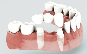 Dental Care Playacar - Dental Care Playacar