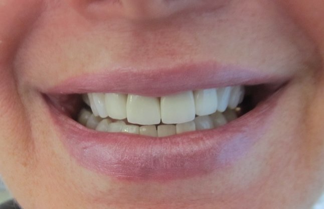 Dental Care Playacar - Dental Care Playacar