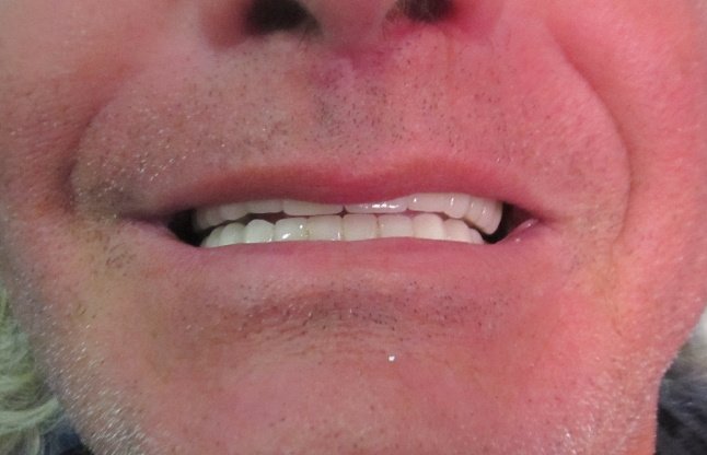 Dental Care Playacar - Dental Care Playacar