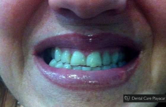 Dental Care Playacar - Dental Care Playacar