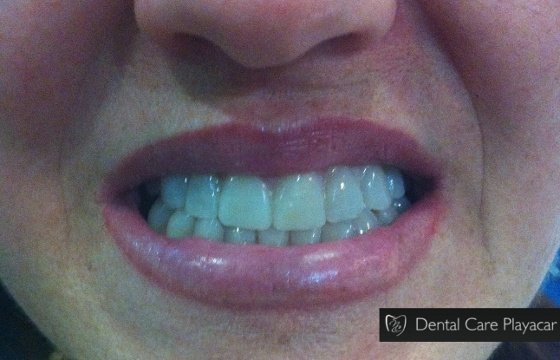 Dental Care Playacar - Dental Care Playacar