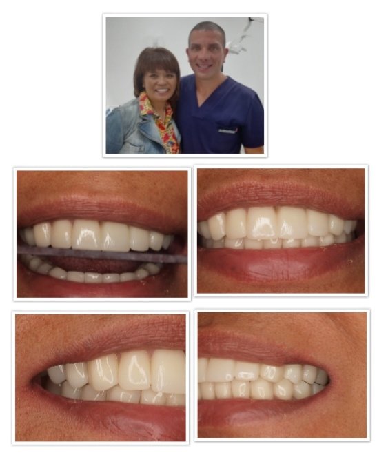 Dental Center Diparr- Tenerife - Dental Center Diparr- Tenerife