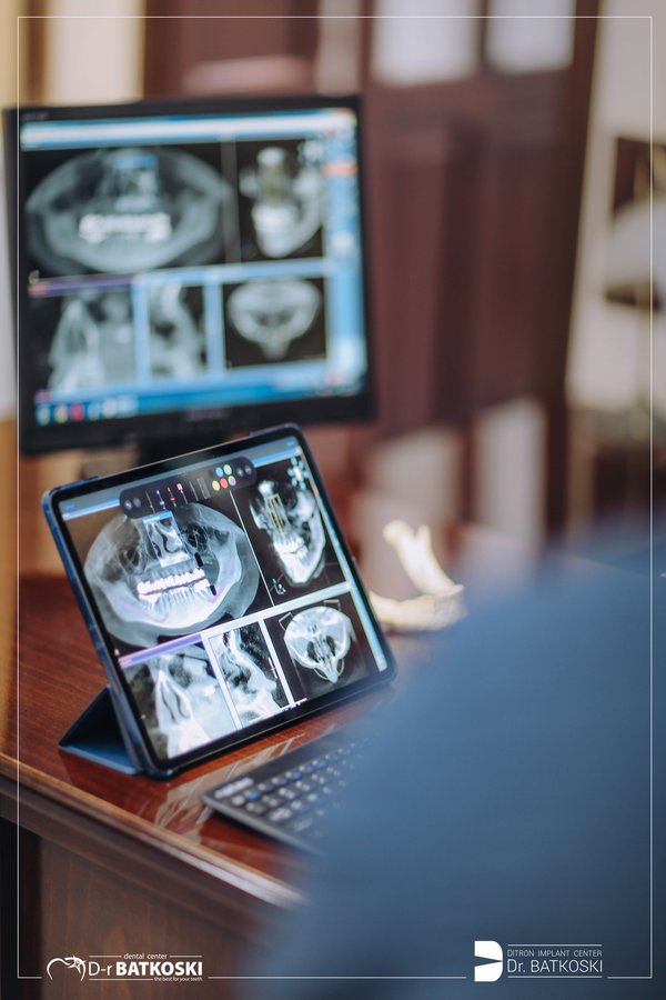 Dental Center Dr. Batkoski - Dental Center Dr. Batkoski