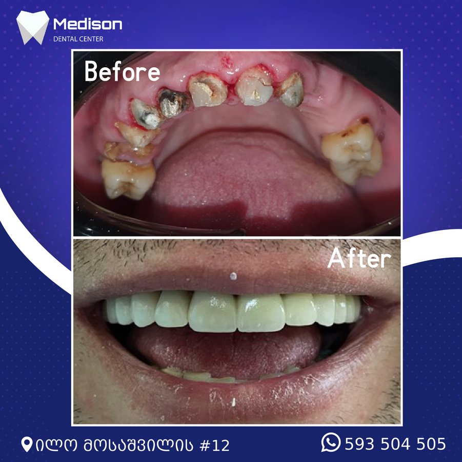 Dental Center Medison - Dental Center Medison