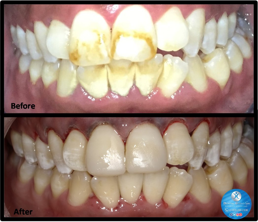 Dental Cibao - Dental Cibao