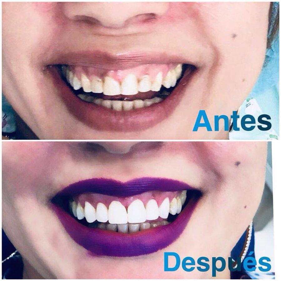 Dental Cibao - Dental Cibao