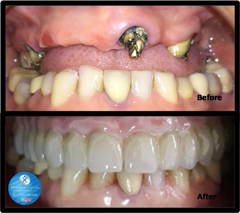 Dental Cibao - Dental Cibao