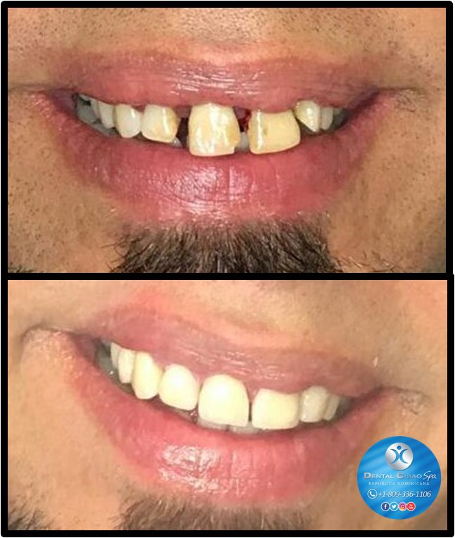 Dental Cibao - Dental Cibao
