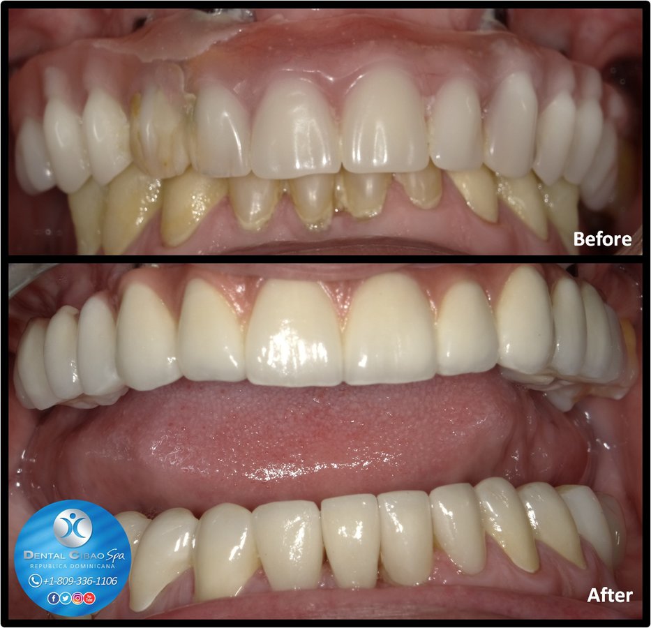 Dental Cibao - Dental Cibao