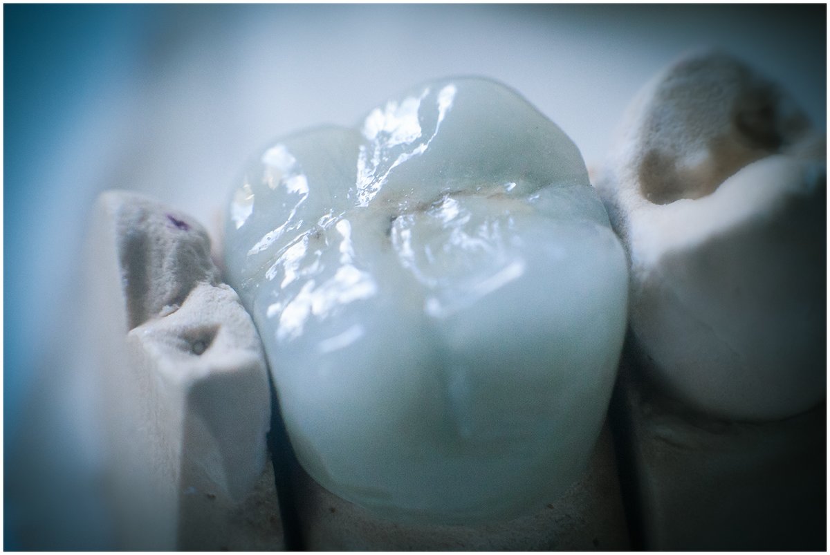 Dental Clinic Lazurit - Dental Clinic Lazurit