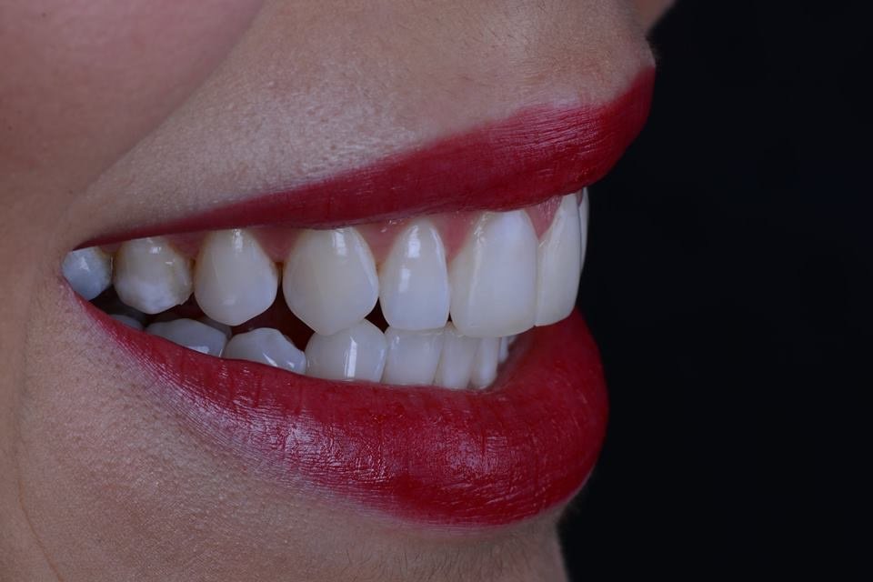 عيادة طب الأسنان في خانيا - Dental Clinic of Chania