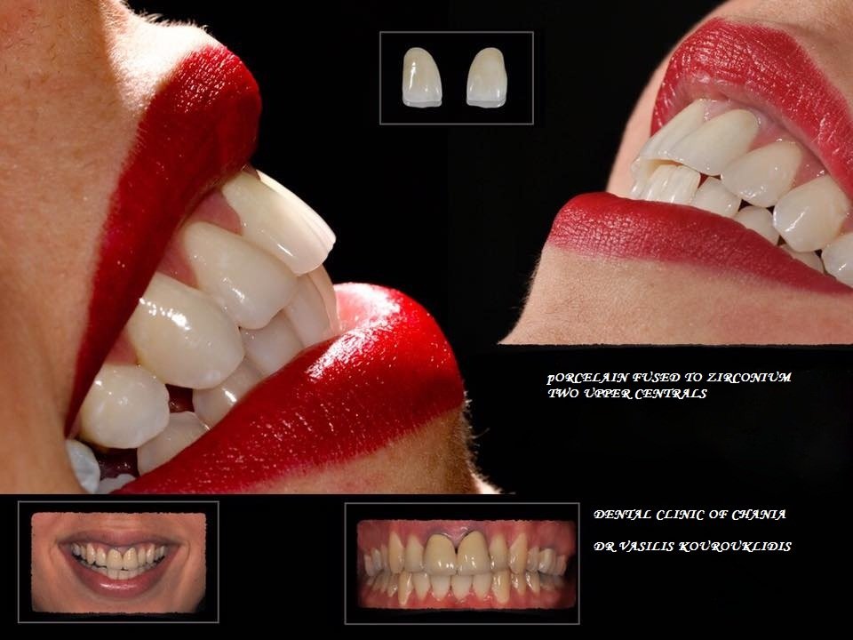 عيادة طب الأسنان في خانيا - Dental Clinic of Chania