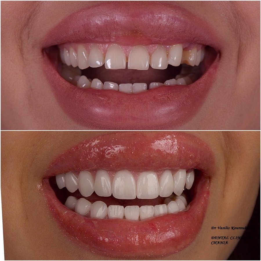 عيادة طب الأسنان في خانيا - Dental Clinic of Chania