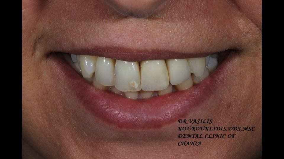 عيادة طب الأسنان في خانيا - Dental Clinic of Chania