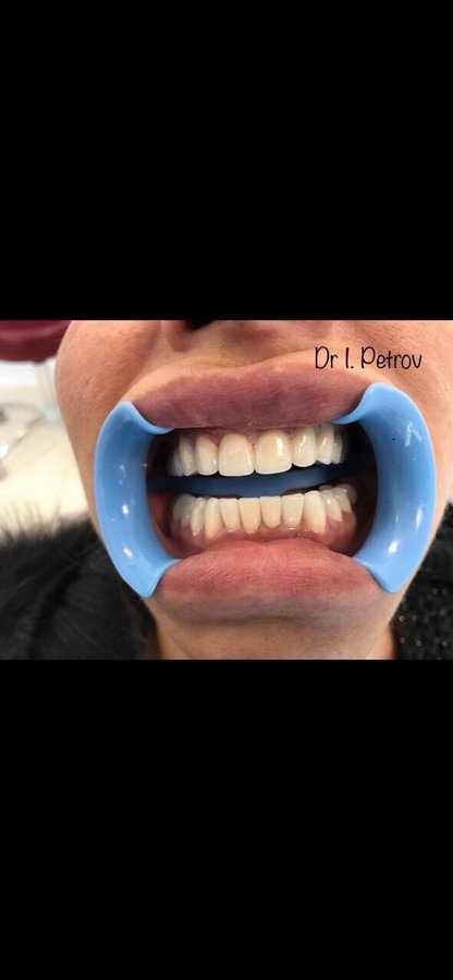 Dental Clinic Petrov - Dental Clinic Petrov