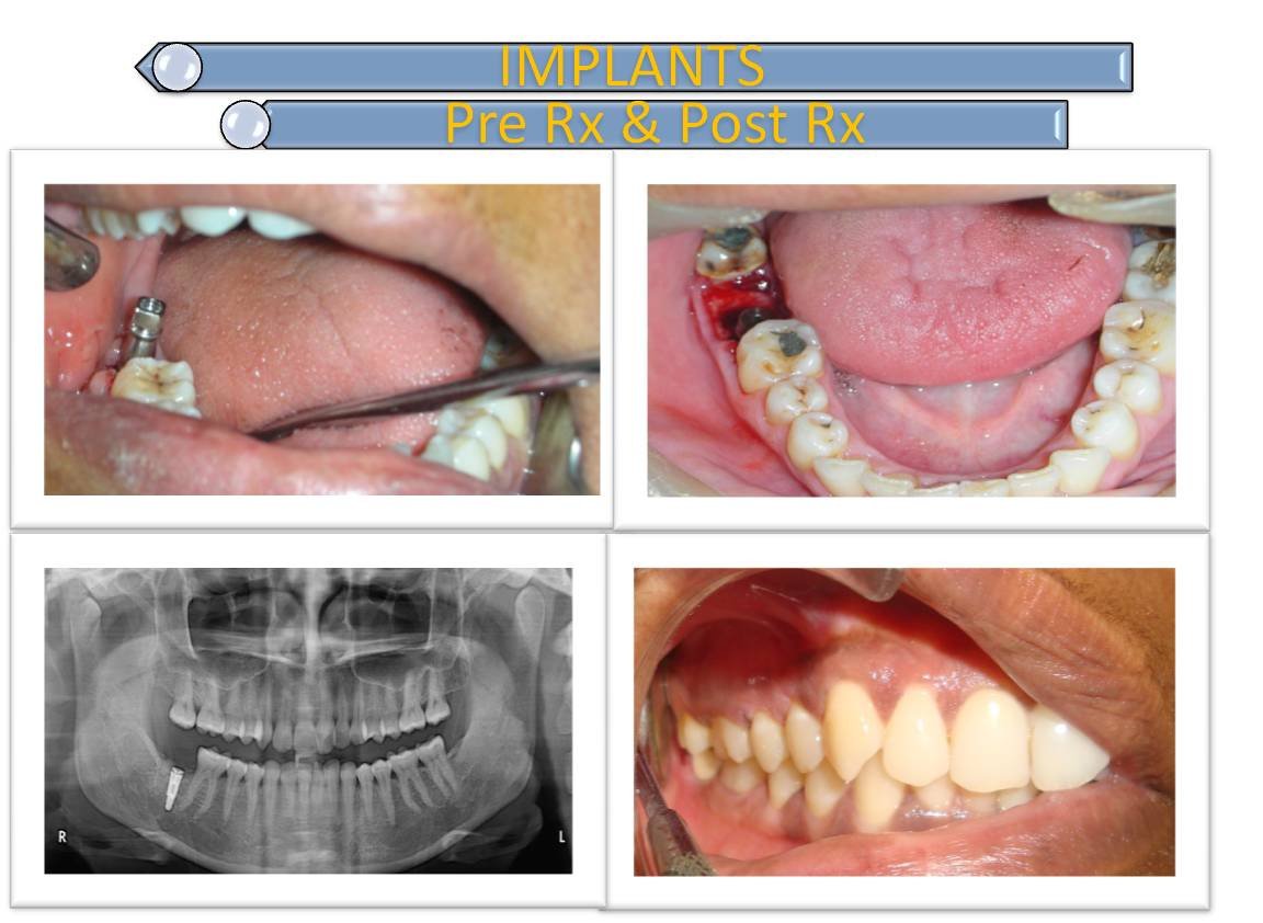 Dental De Care - Dental De Care