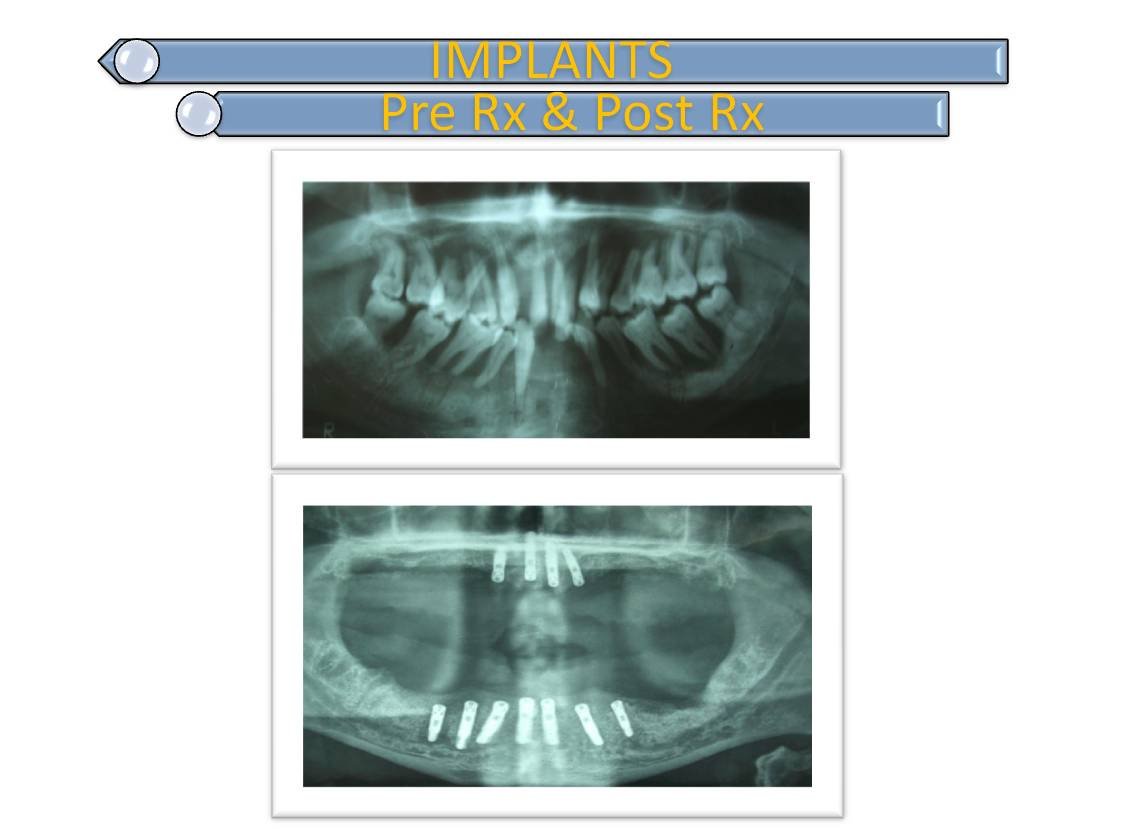 Dental De Care - Dental De Care
