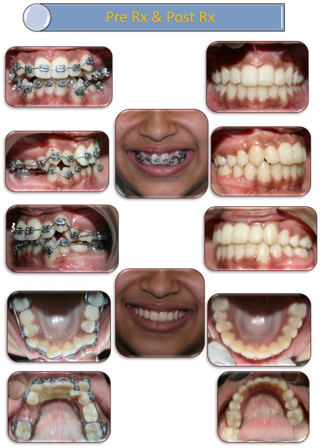 Dental De Care - Dental De Care