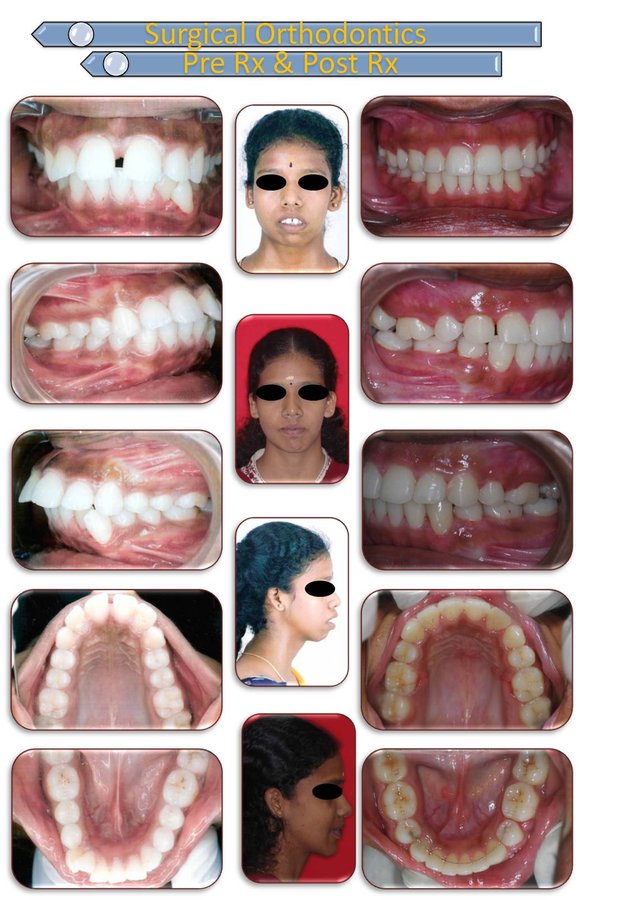 Dental De Care - Dental De Care