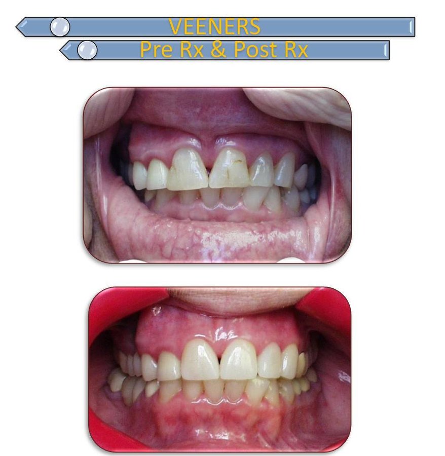 Dental De Care - Dental De Care