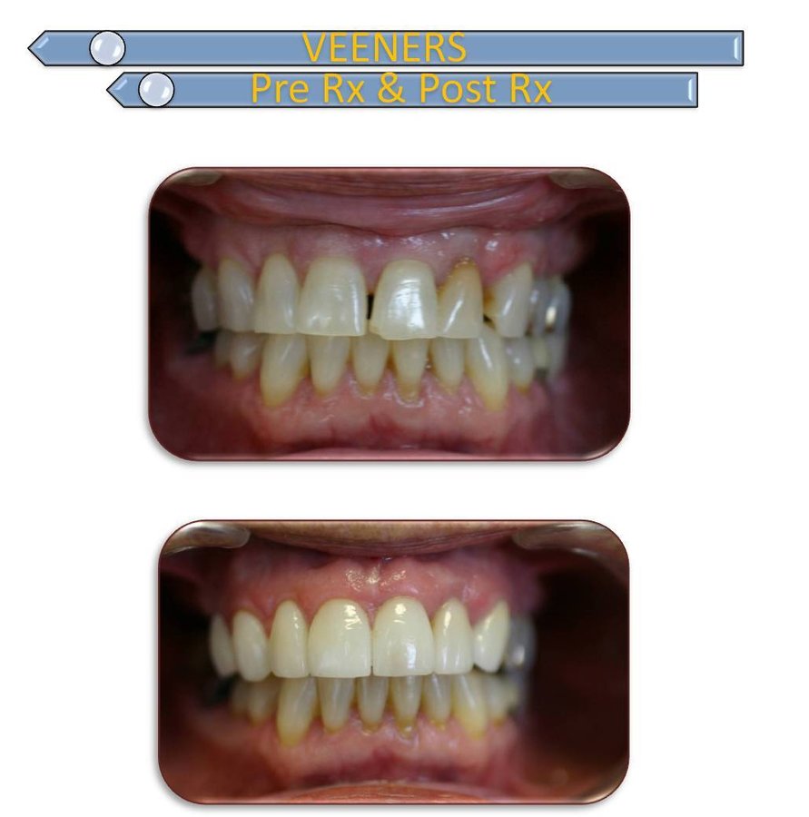 Dental De Care - Dental De Care