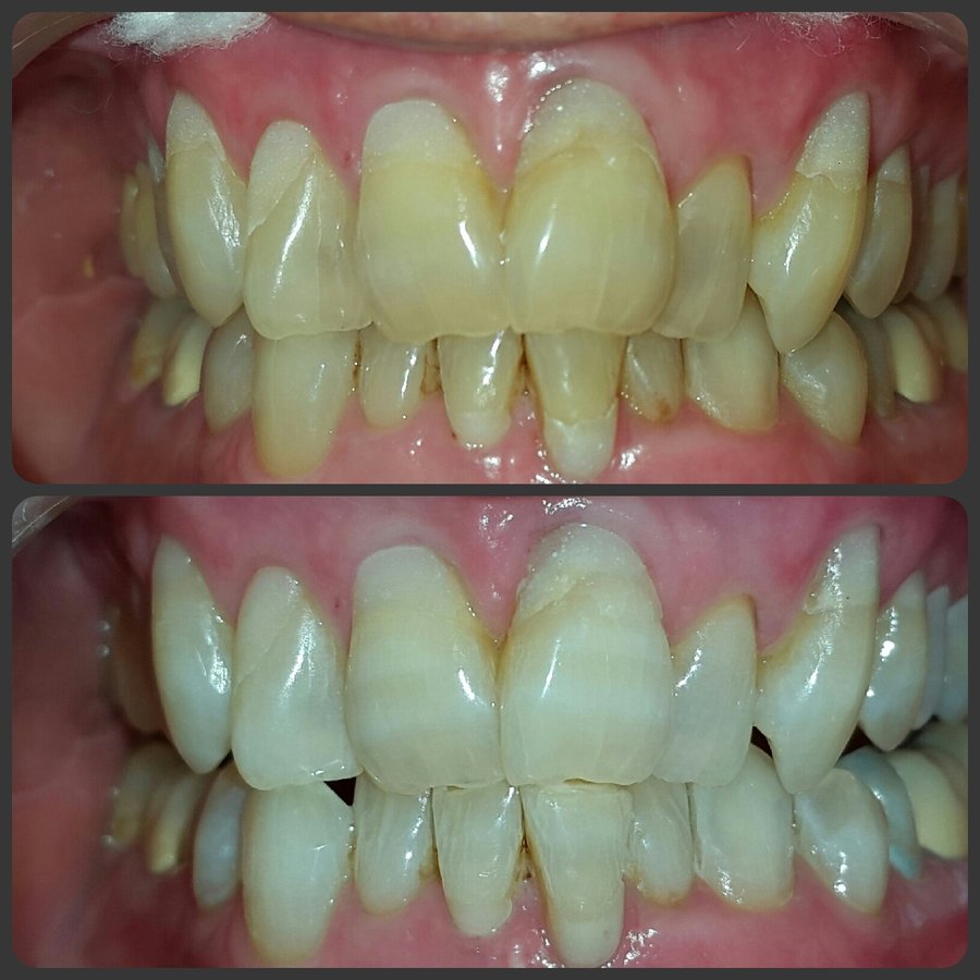 Dental Designs - Dental Designs