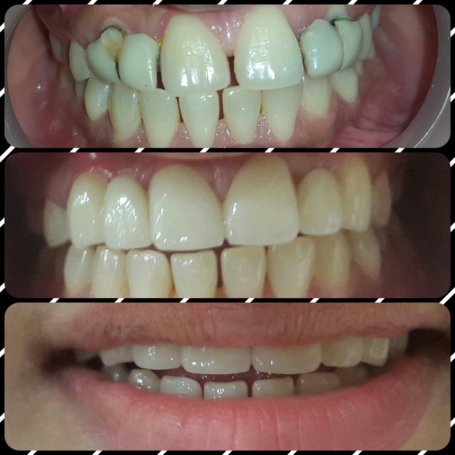 Dental Designs - Dental Designs