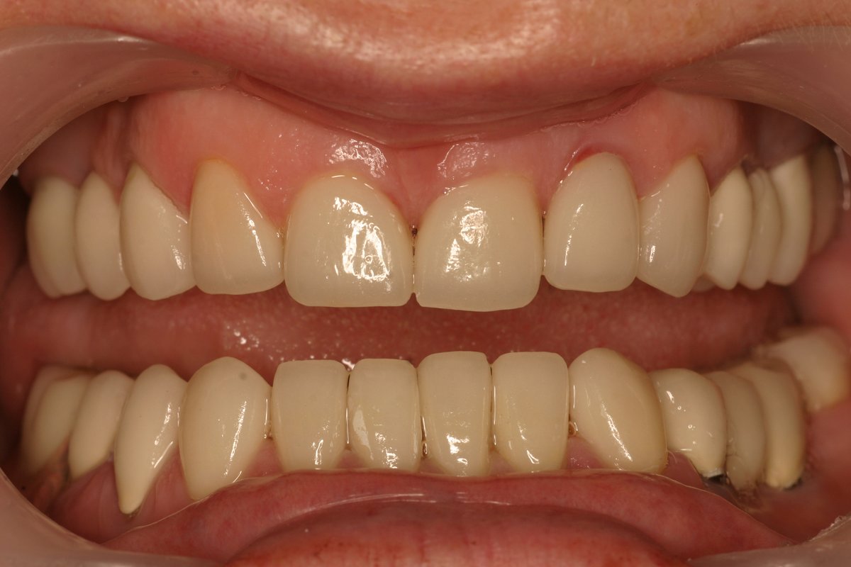 Dental Designs - Dental Designs