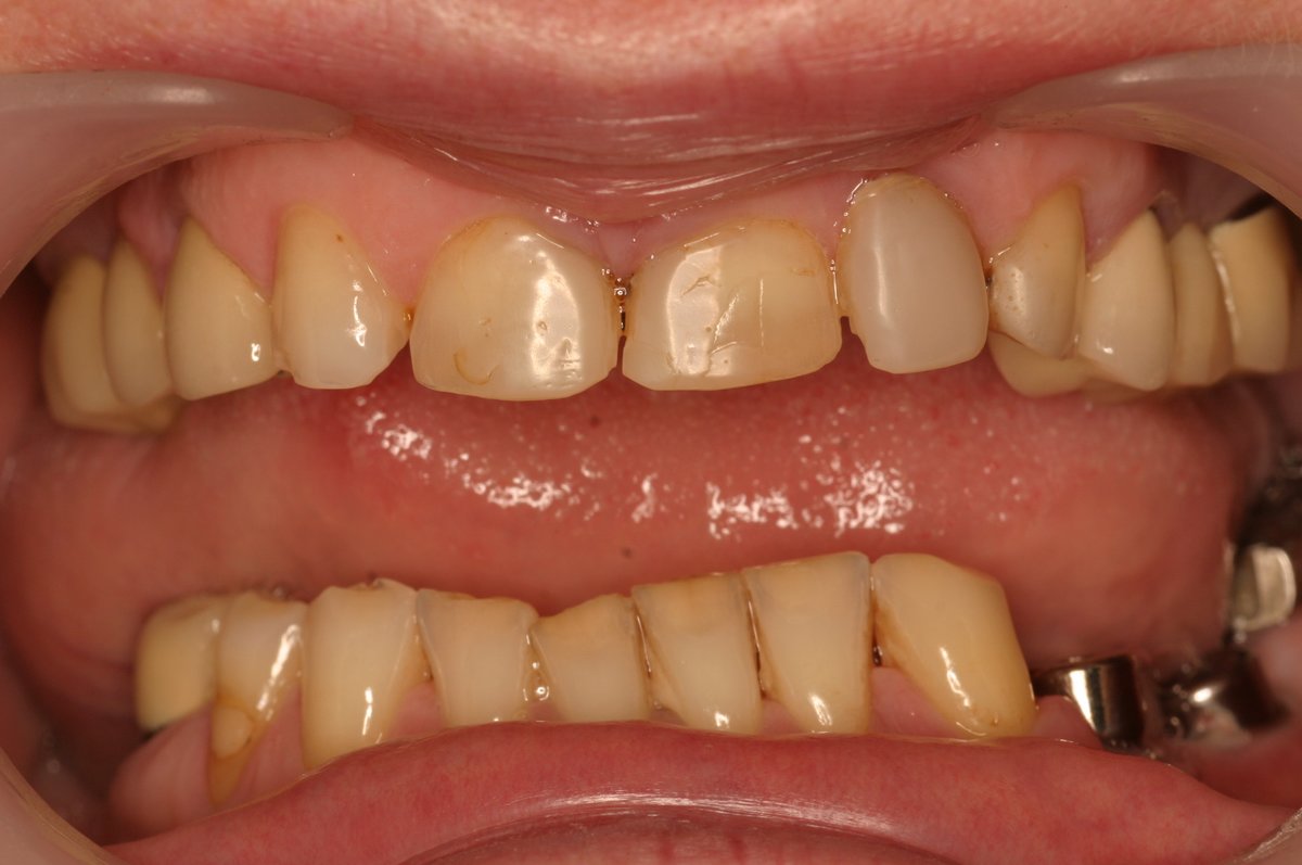 Dental Designs - Dental Designs