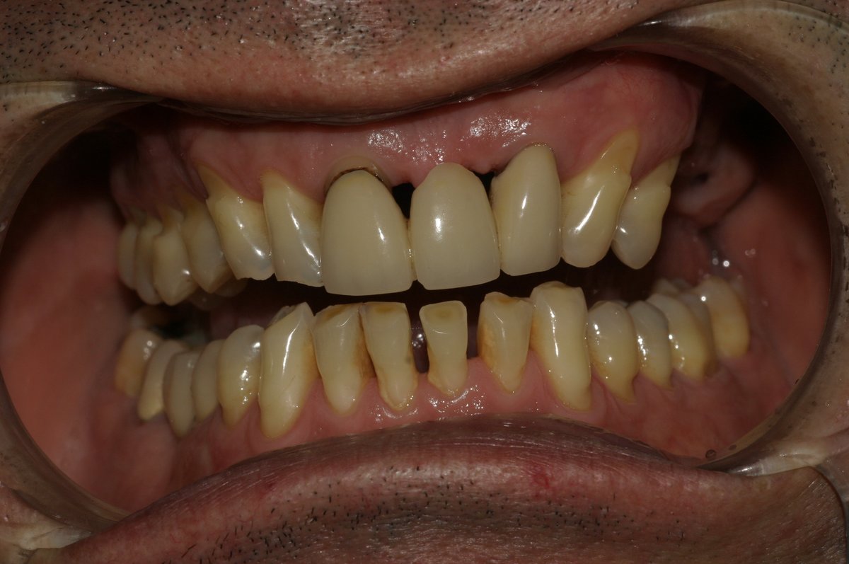 Dental Designs - Dental Designs