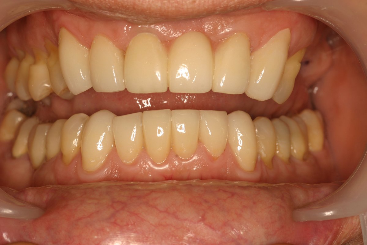 Dental Designs - Dental Designs