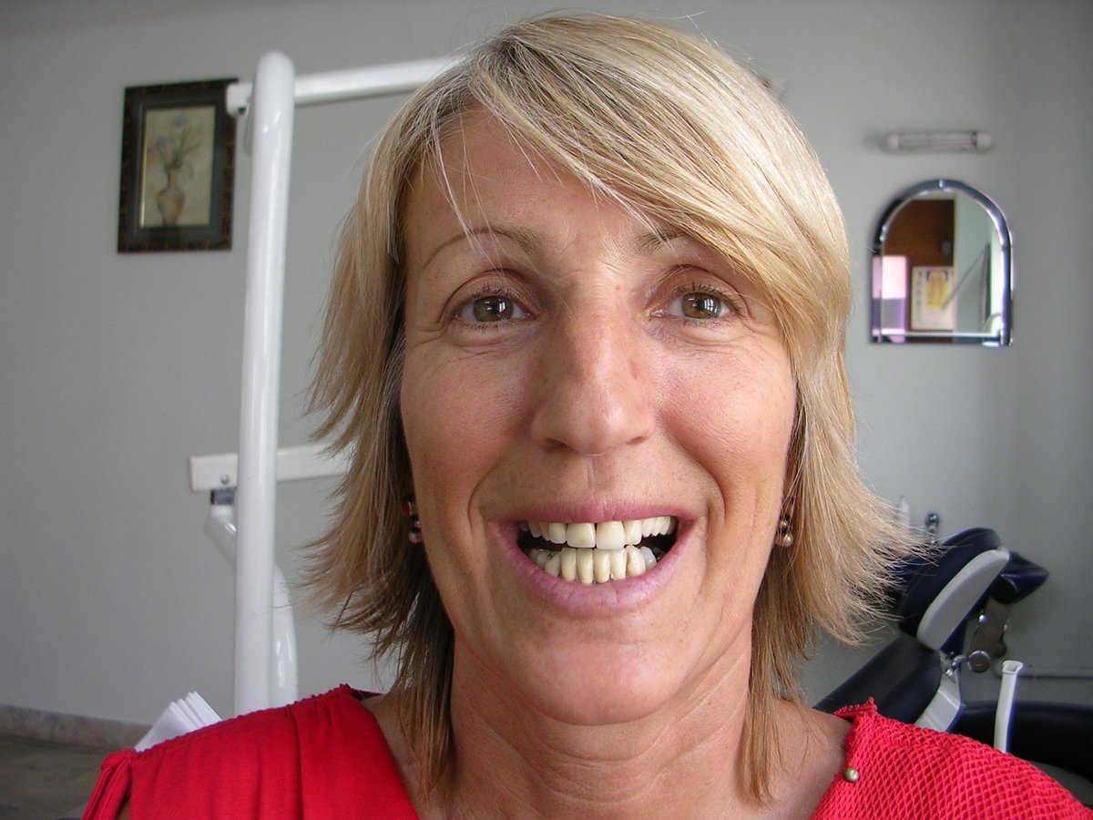 Dental Designs - Dental Designs