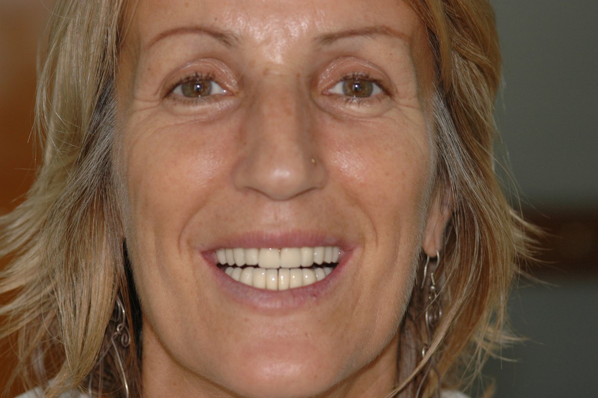 Dental Designs - Dental Designs