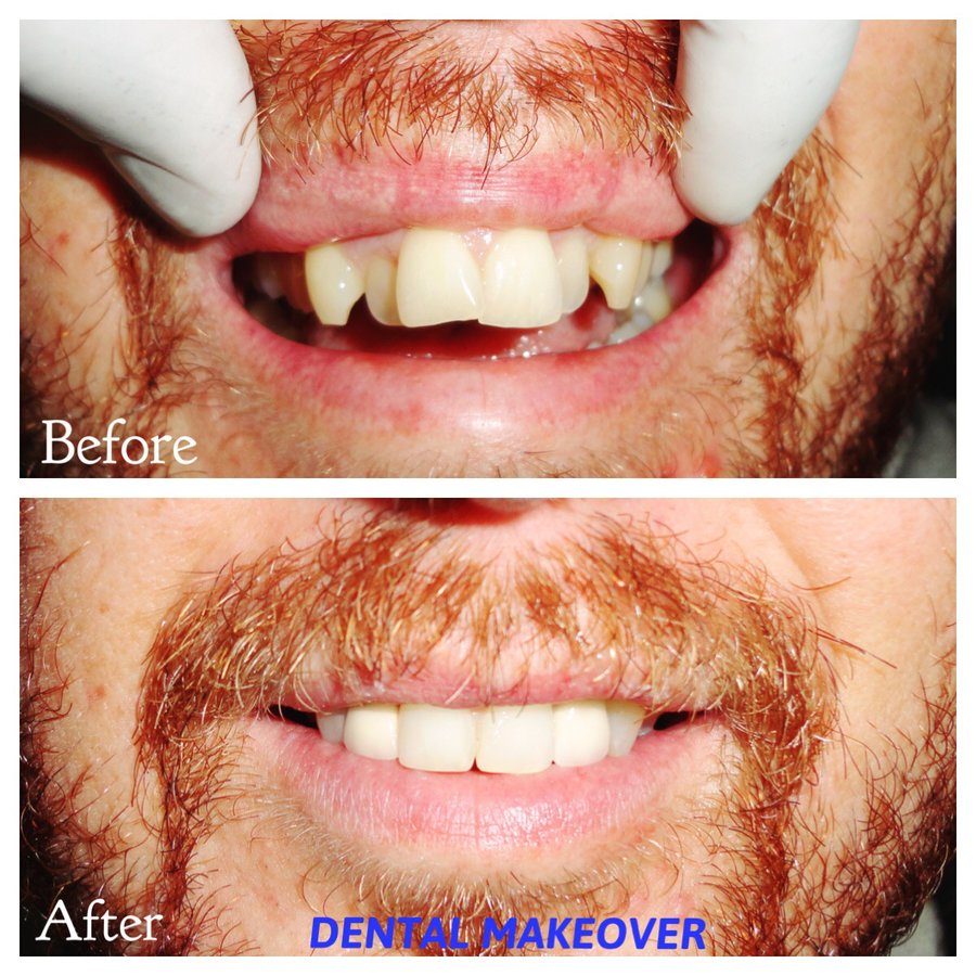 DENTAL MAKEOVER - DENTAL MAKEOVER