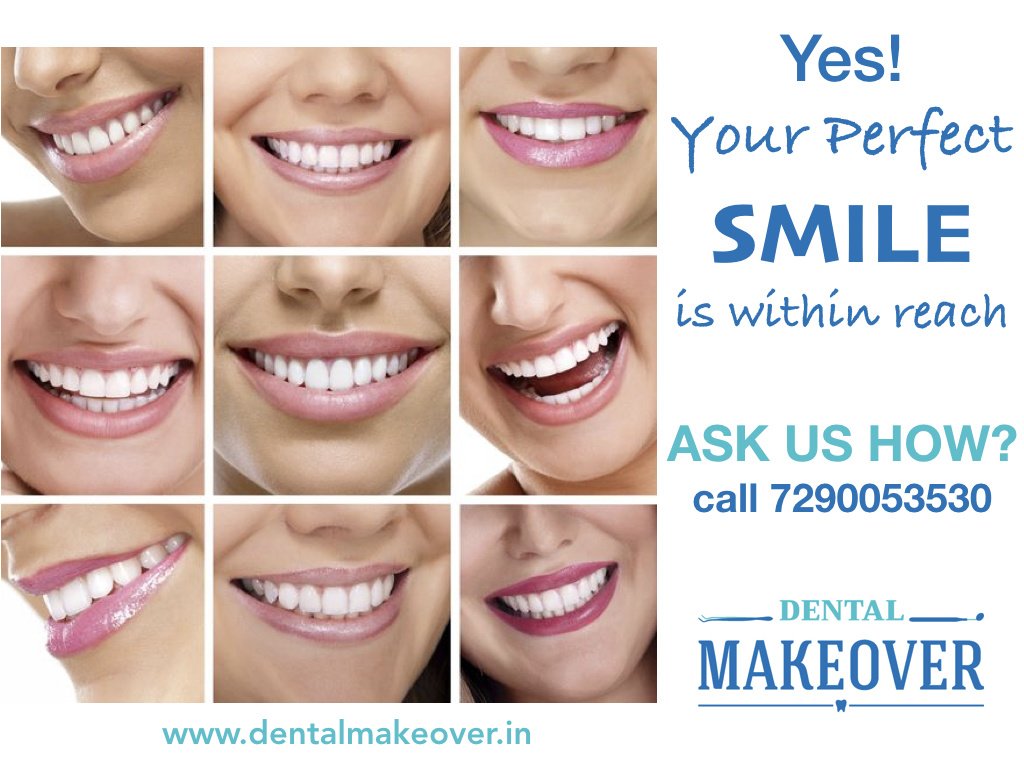 DENTAL MAKEOVER - DENTAL MAKEOVER