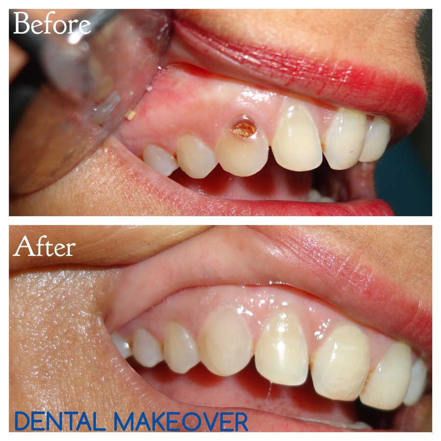 DENTAL MAKEOVER - DENTAL MAKEOVER