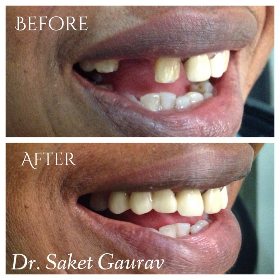 DENTAL MAKEOVER - DENTAL MAKEOVER
