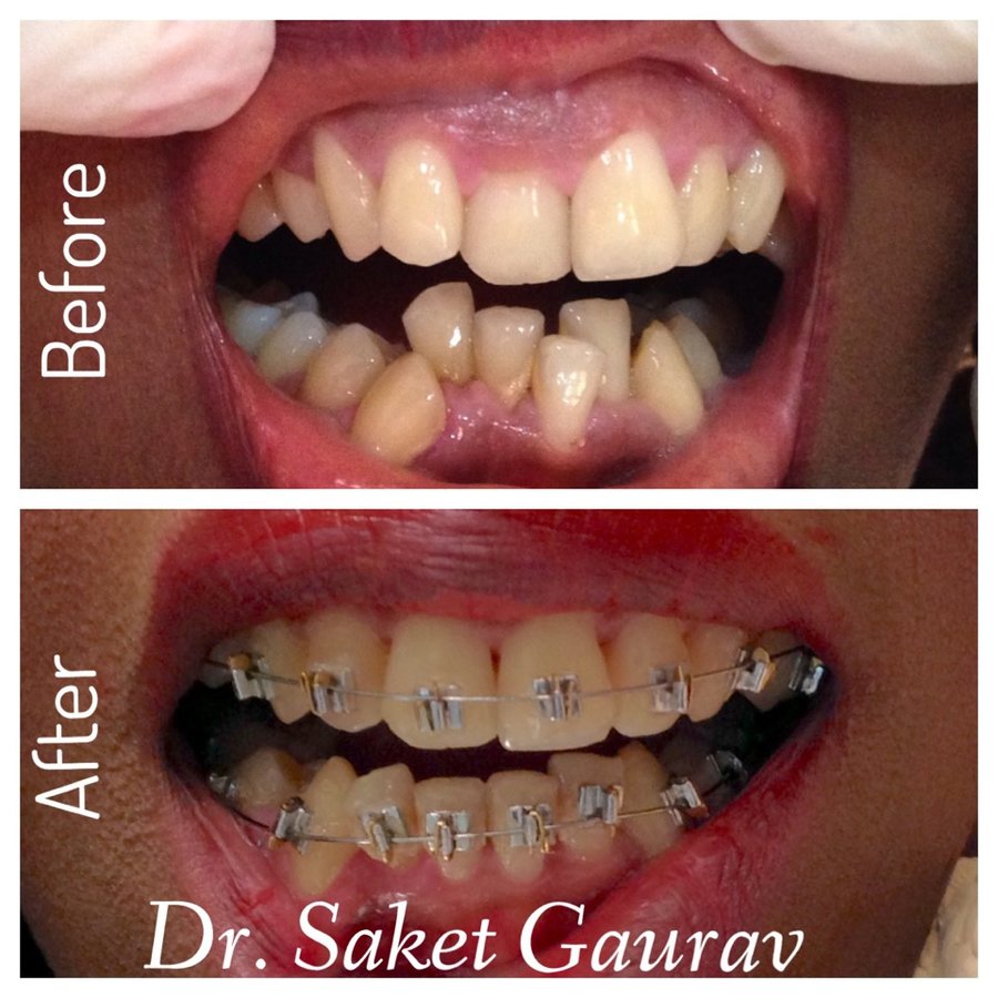 DENTAL MAKEOVER - DENTAL MAKEOVER
