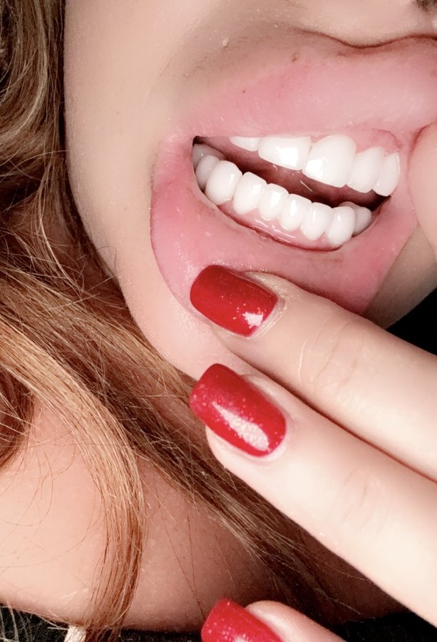 Dental Marmaris - Celebi Dental Clinic - Dental Marmaris - Celebi Dental Clinic