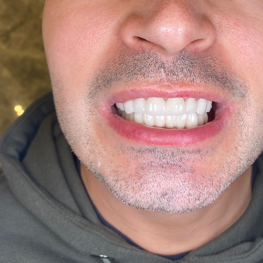 Dental Marmaris - Celebi Dental Clinic - Dental Marmaris - Celebi Dental Clinic