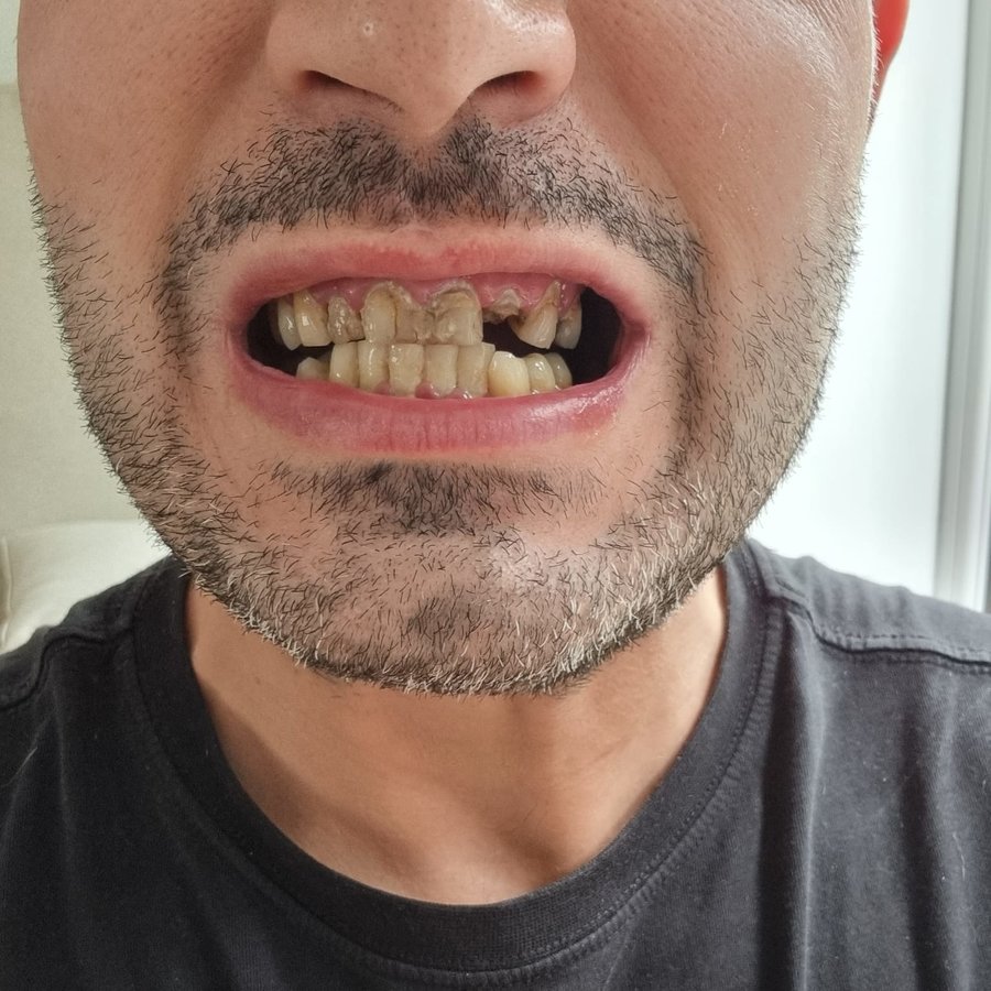 Dental Marmaris - Celebi Dental Clinic - Dental Marmaris - Celebi Dental Clinic