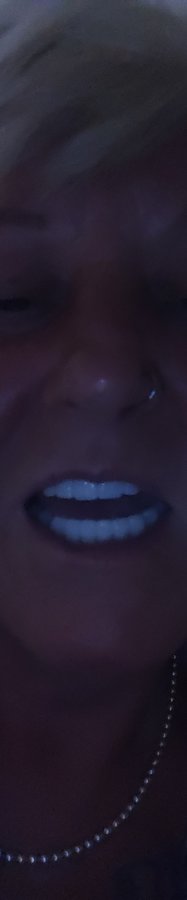 Dental Marmaris - Celebi Dental Clinic - Dental Marmaris - Celebi Dental Clinic